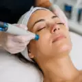 Hydrafacial : le guide complet pour tout savoir avant de réserver 