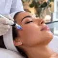 Microneedling : bienfaits, résultats, prix et risques avant de se lancer