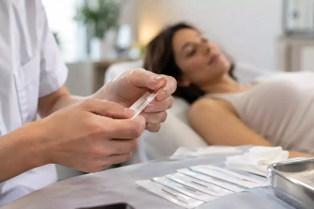 Aiguilles stériles utilisées lors d’une séance d’acupuncture