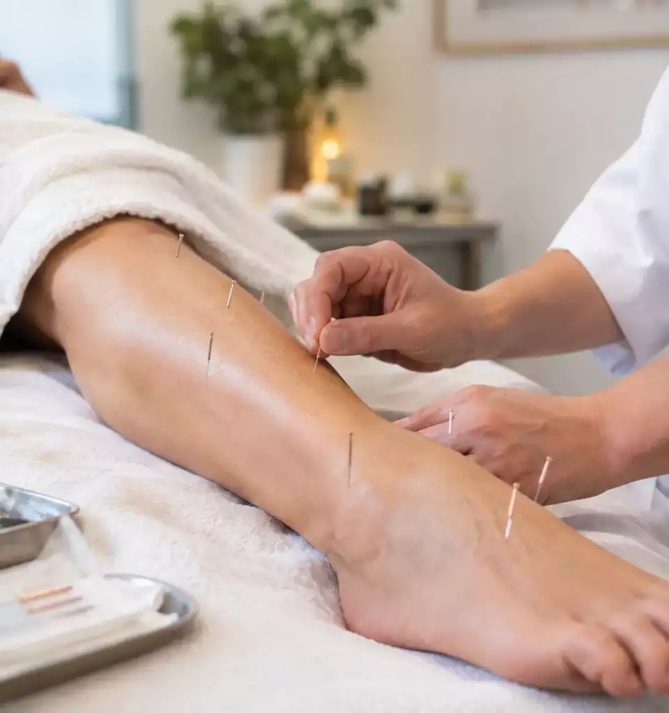 Zones du corps pouvant être stimulées par les aiguilles d’acupuncture